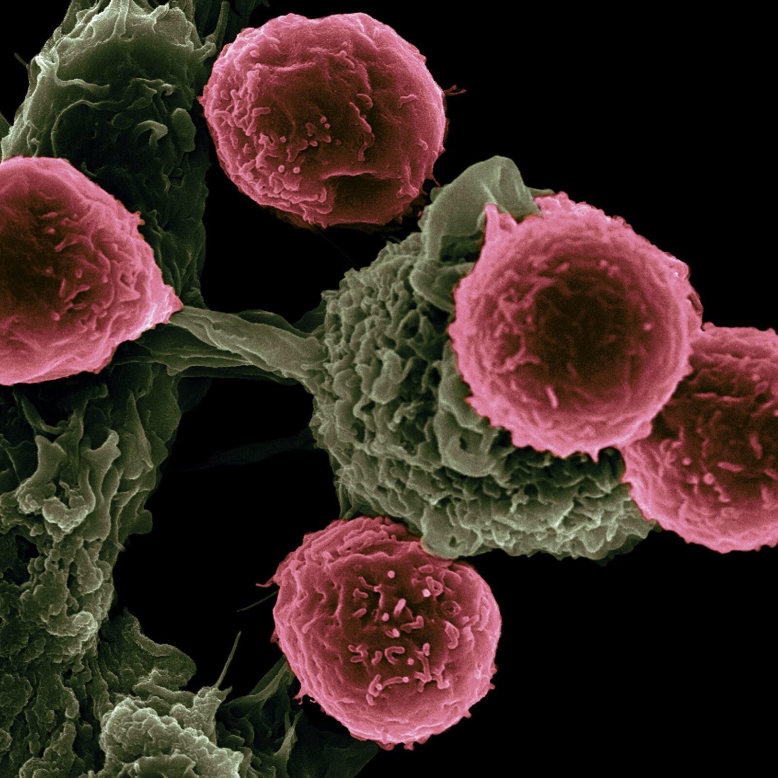 Cancer cells that can be cured by marine bacteriun